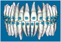 SureSmile Digital Orthodontic Treatment Planning